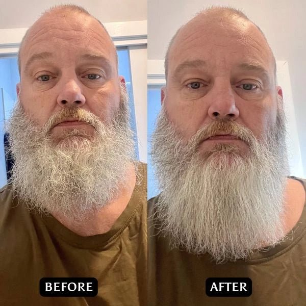 Skol's Wireless Heated Beard Styling Brush + FREE 50mL Beard Oil - Image 7